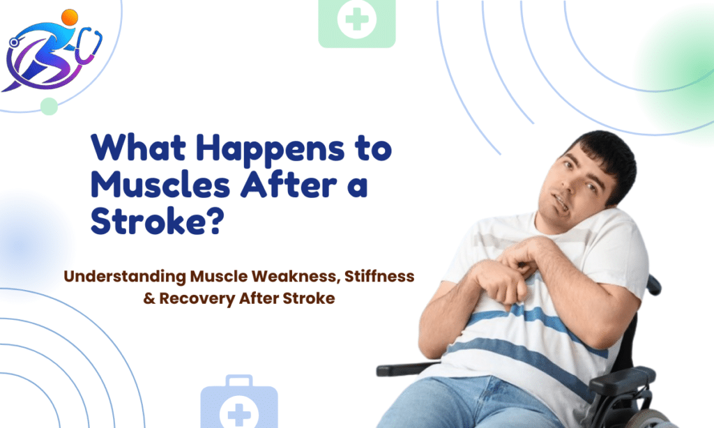 Muscle weakness and stiffness after stroke showing how brain damage affects arm and leg muscles