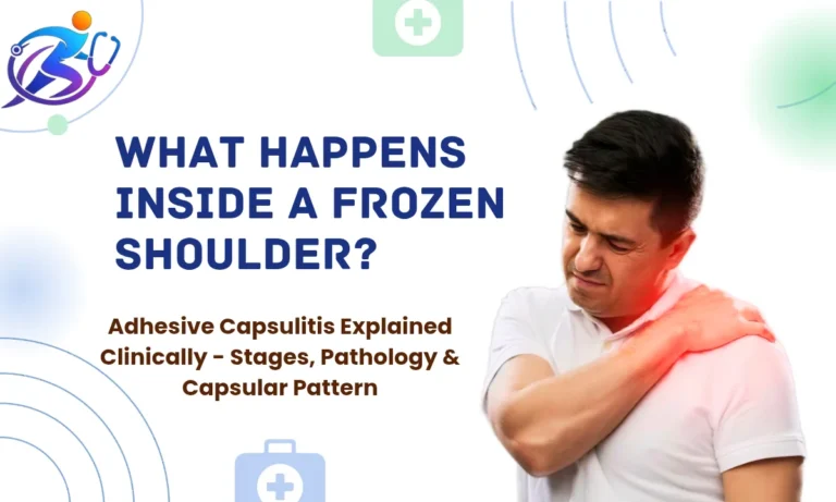 Man holding painful shoulder with red highlight illustrating frozen shoulder (adhesive capsulitis) and capsular pattern restriction explained clinically.