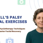 physiotherapy facial exercises for bells palsy recovery