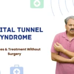 Cubital tunnel syndrome physiotherapy exercises and treatment without surgery